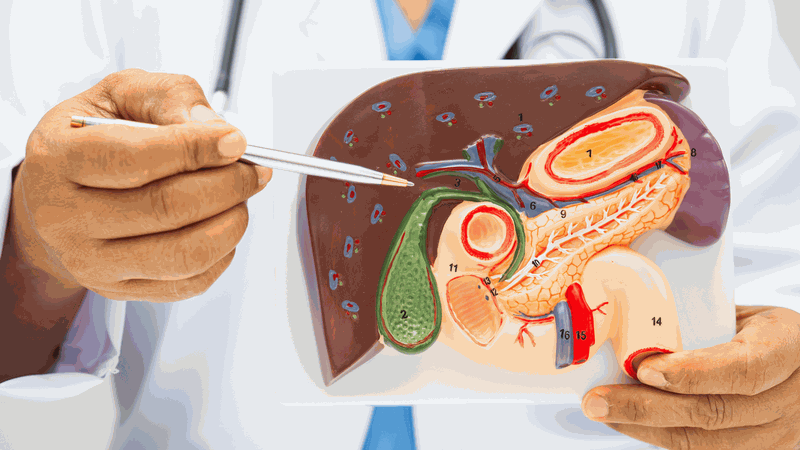 Viêm túi mật cũng cần được điều trị nhanh chóng để tránh biến chứng, đặc biệt là khi có sự xuất hiện của sỏi mật