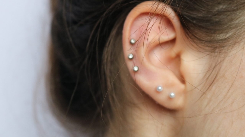 Viêm sụn vành tai là gì? Cần cẩn thận với các triệu chứng gây viêm 1