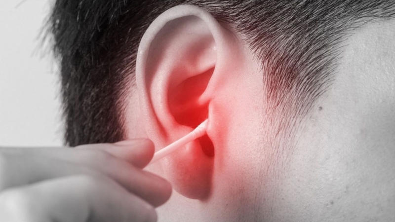 Vệ sinh tai sai cách là một trong những nguyên nhân gây viêm tai giữa vỡ mủ