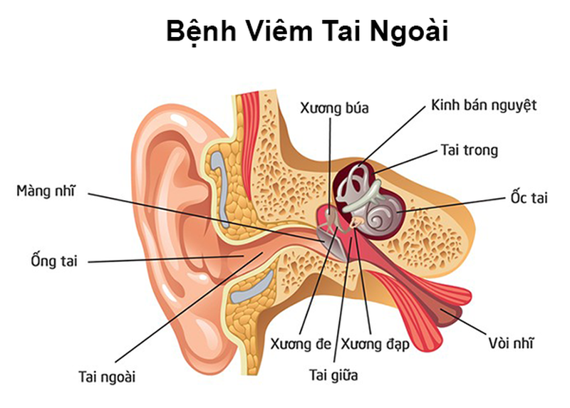 Mô phỏng ống tai của bệnh nhân viêm tai ngoài