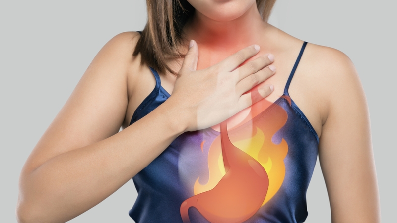 Viêm thực quản trào ngược độ A là một thể nhẹ trong phổ tổn thương niêm mạc thực quản do bệnh trào ngược dạ dày - thực quản (GERD) gây ra