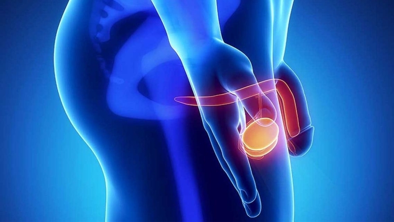 Viêm tinh hoàn nên kiêng gì là vấn đề cần lưu ý trong quá trình hồi phục
