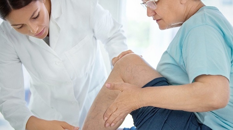 Viêm tĩnh mạch: Nguyên nhân, triệu chứng và cách điều trị bệnh 2