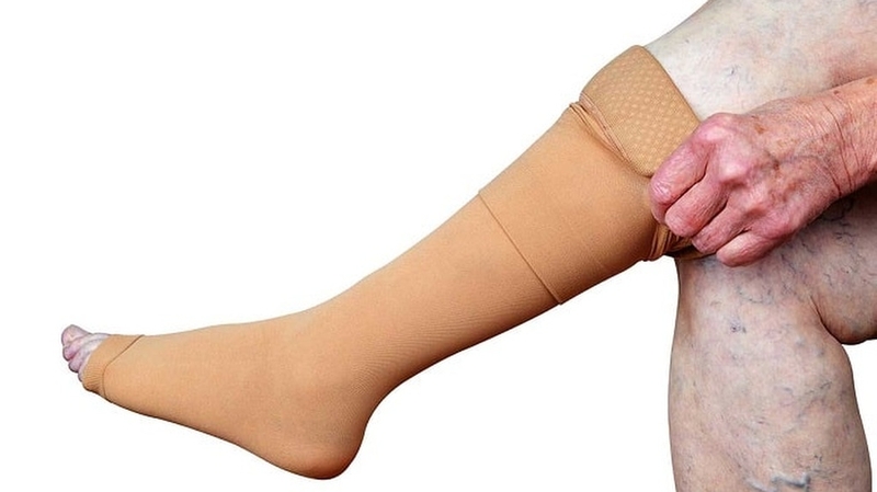 Viêm tĩnh mạch: Nguyên nhân, triệu chứng và cách điều trị bệnh 4