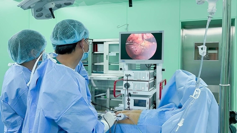 viêm túi mật hoại tử và những điều cần biết