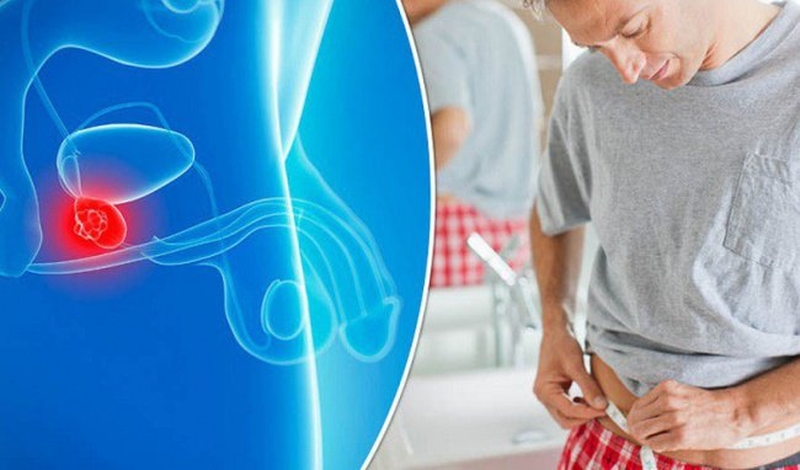 Bật mí cách chữa viêm tuyến tiền liệt hiệu quả hiện nay 1