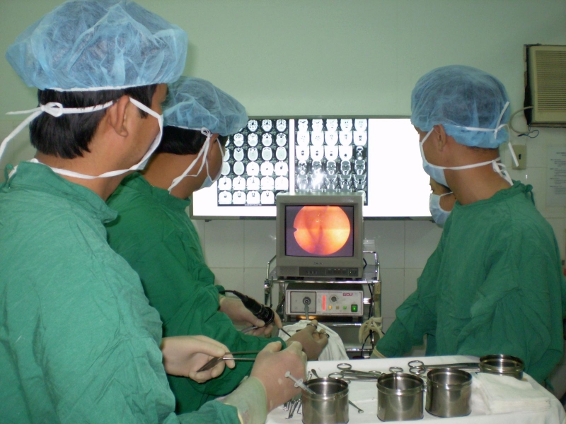 Viêm xoang Polyp mũi điều trị thế nào? 4