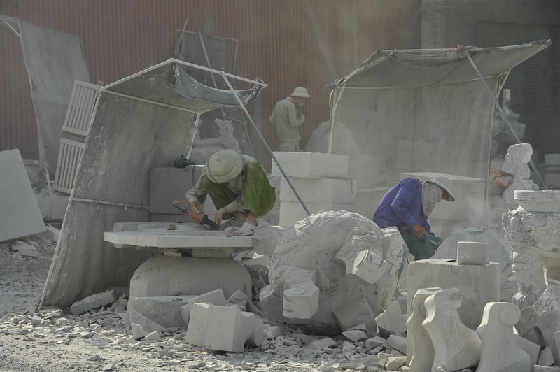 Viêm xoang có nên mổ không và khi nào thì cần mổ? 2