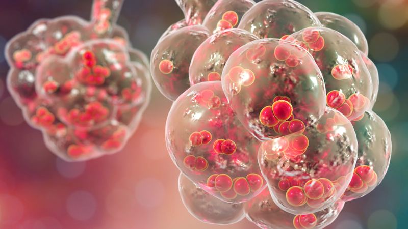 Viêm xoang do phế cầu có nguy hiểm không? Cách phòng ngừa hiệu quả 3