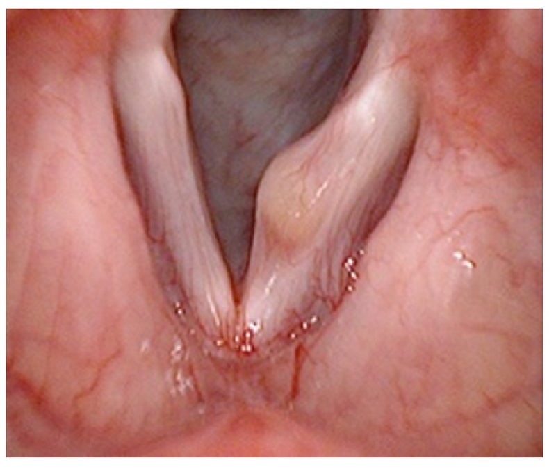 Viêm xoang khó thở có nguy hiểm không 2