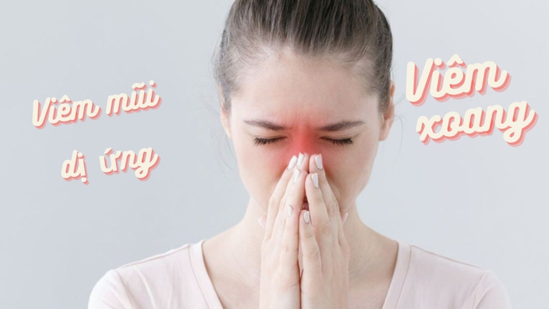 Việc phân biệt viêm xoang và viêm mũi dị ứng giúp bác sĩ có phương pháp điều trị thích hợp