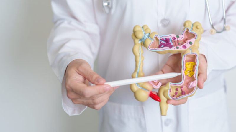 Viêm xung huyết trực tràng là gì? Nguyên nhân và dấu hiệu nhận biết 3