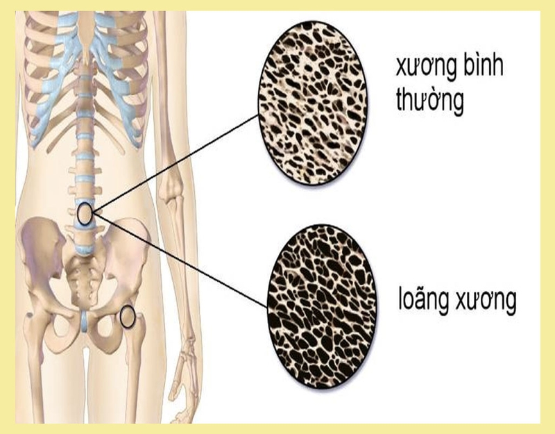 Viên uống Dr. Caci Ocavill - Bổ sung canxi giảm nguy cơ loãng xương 2