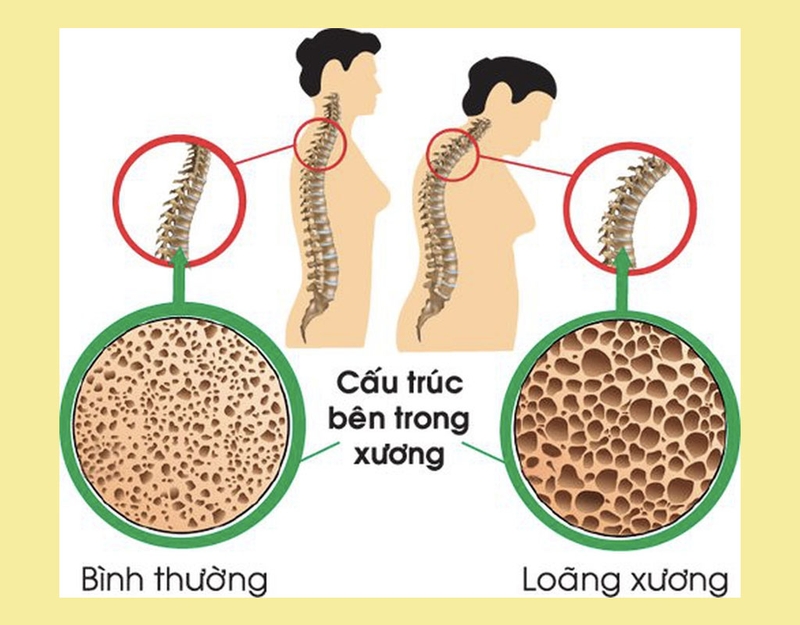 Viên Uống Magnesium + Calcium + D3 bảo vệ sức khoẻ như thế nào?2