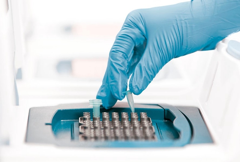 Việt Nam chế tạo thành công kit thử chẩn đoán virus SARS-CoV-2 chỉ sau 80 phút 3