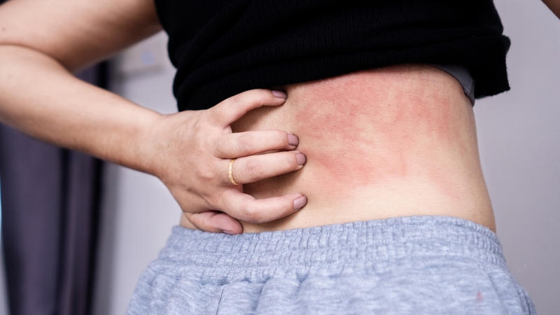 Một số người có cơ địa dị ứng với các loại quả mọng có thể cũng bị dị ứng với việt quất