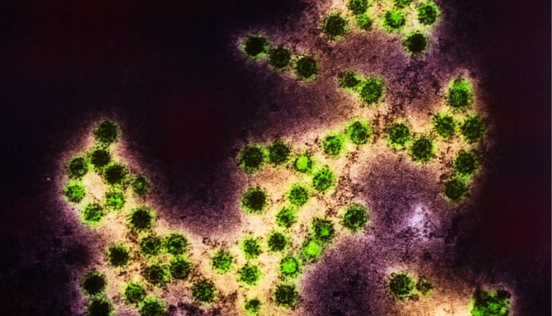 Virus Coxsackie A16 là gì? Gây bệnh gì và cách phòng ngừa ra sao 1