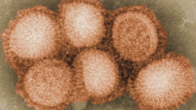 virus-h2-n2-la-gi-cac-yeu-to-quan-trong-can-luu-y-de-dam-bao-suc-khoe-cong-dong 1