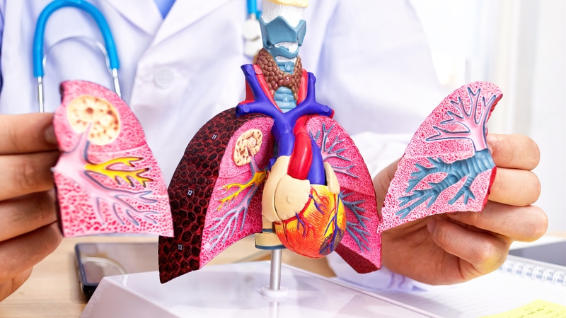 Nhiễm virus Hanta có thể chuyển sang các thể bệnh nghiêm trọng như hội chứng tim phổi do hantavirus (HCPS)