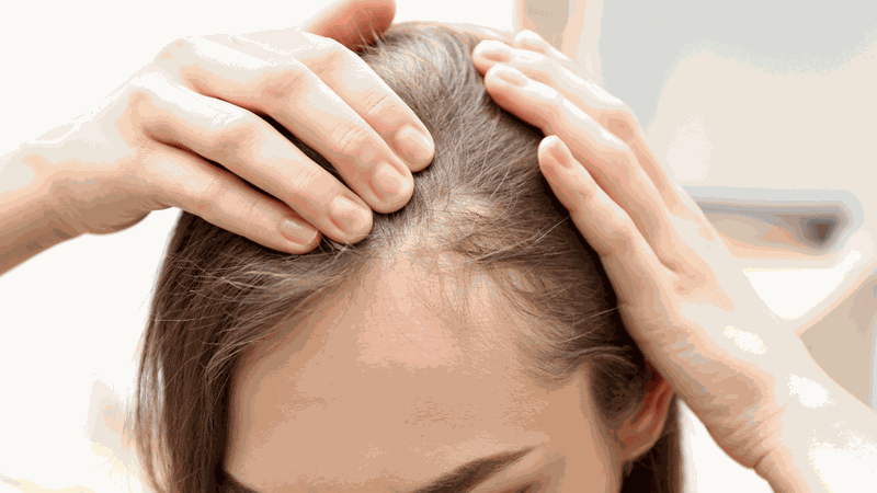 virus hói hiện tượng lạ kỳ khiến rụng tóc chỉ trong vài ngày 2