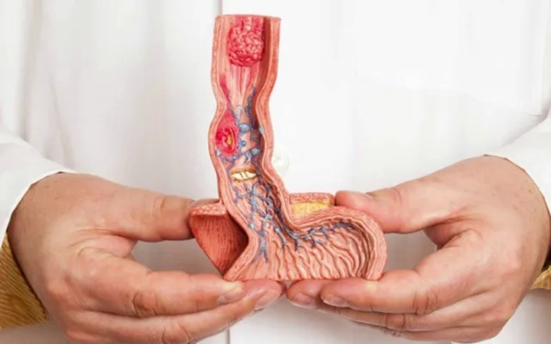 Virus HPV có gây ung thư dương vật không? 2