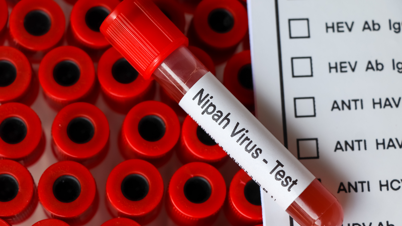 Hiện nay, chưa có vắc xin phòng bệnh và thuốc điều trị đặc hiệu đối với virus Nipah