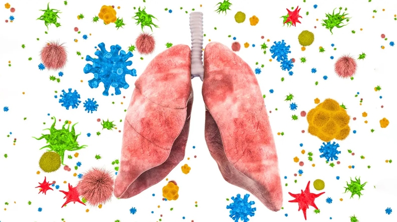 Virus Paramyxovirus: Nguyên nhân gây nhiều bệnh lý nguy hiểm 2