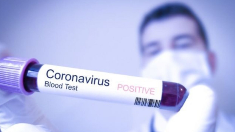 Virus SARS-CoV-2 có thể bám trên bề mặt khẩu trang đến một tuần 1