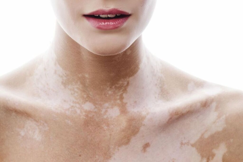 Vitamin B10 có tác dụng gì? 2