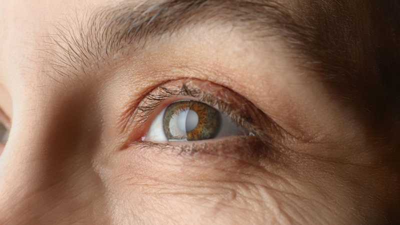 Vitamin B2 - Loại vitamin ít ai nghĩ đến lại giúp đôi mắt khỏe mạnh 2