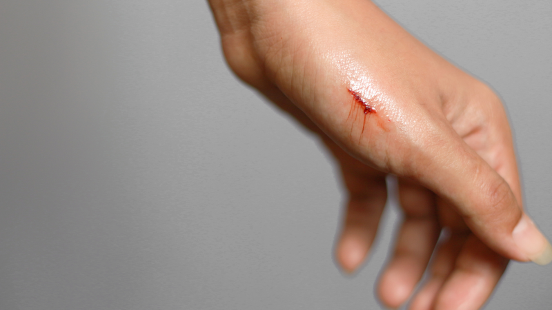 Vitamin B5 có vai trò trong quá trình tái tạo mô và phục hồi tế bào, do đó có thể giúp vết thương lành nhanh hơn