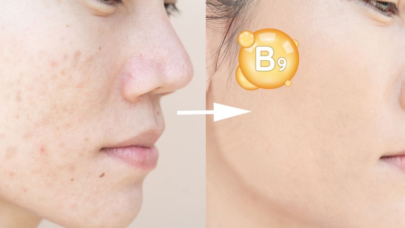 Vitamin B9 là thành phần hỗ trợ tái tạo và phục hồi làn da sau tổn thương