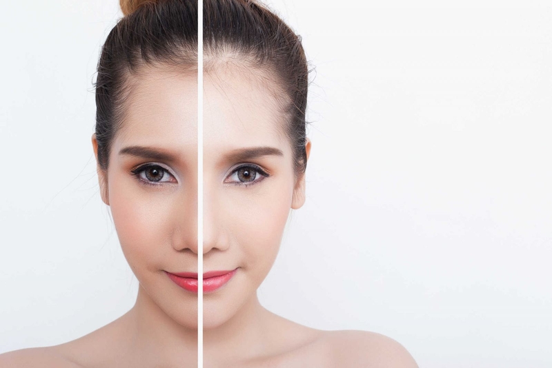 Vitamin C có thể giúp làn da chống lão hóa, dưỡng ẩm, làm trắng da