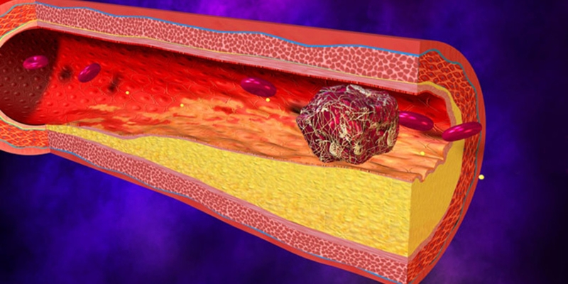 Vitamin K1 là gì? Tác dụng của vitamin K1 2