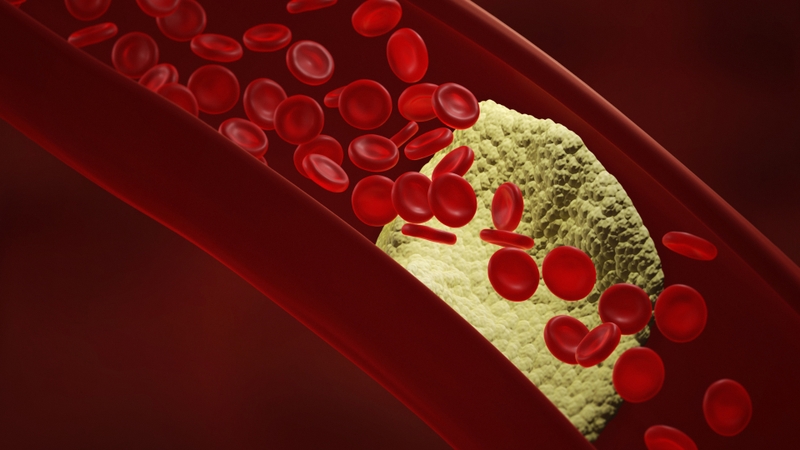 Vitamin K có thực sự giúp xương chắc khỏe? 2