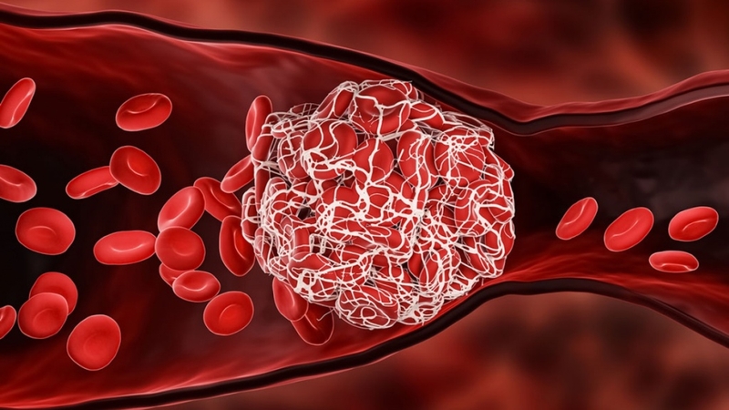 Vitamin K là gì? Vai trò của vitamin K đối với sức khỏe 2