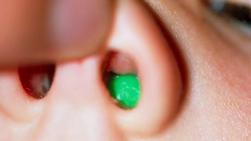 Làm thế nào khi trẻ nhét dị vật vào mũi? 3