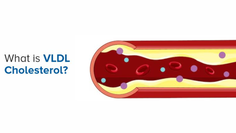 VLDL cholesterol là gì? Cấu tạo và chức năng 1
