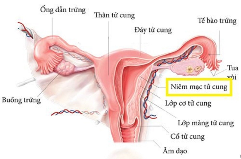 Vô sinh do không có tử cung có điều trị và phòng ngừa được không? 1