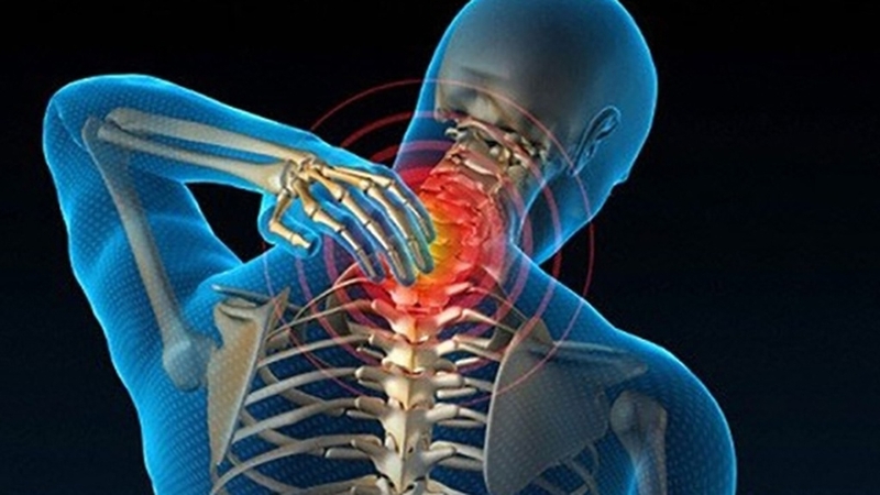 Vôi hóa cột sống có chữa được không? Biện pháp phòng ngừa và cách điều trị bệnh hiệu quả 1