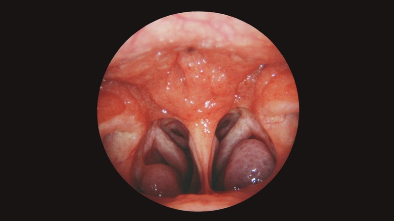 Cấu tạo của vòm họng gồm nhiều thành phần với chức năng khác nhau