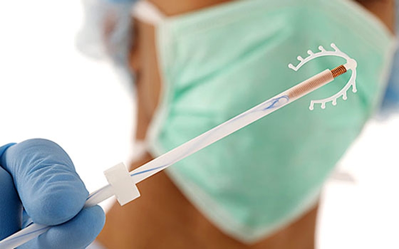 sau-khi-sinh-mo-bao-lau-thi-dat-vong-tranh-thai-duoc-2