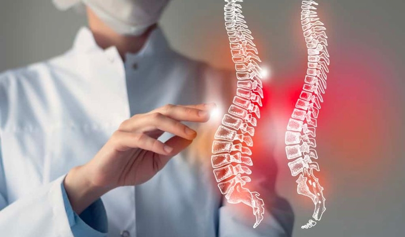 Võng lưng là gì? Cách nhận biết và điều trị 1