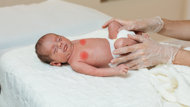 Vú của trẻ sơ sinh có cục cứng: Nguyên nhân, dấu hiệu và hướng xử trí 2