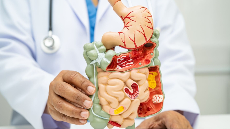 Đau vùng chậu có thể là dấu hiệu cảnh báo sớm các bệnh lý liên quan đến tiêu hóa