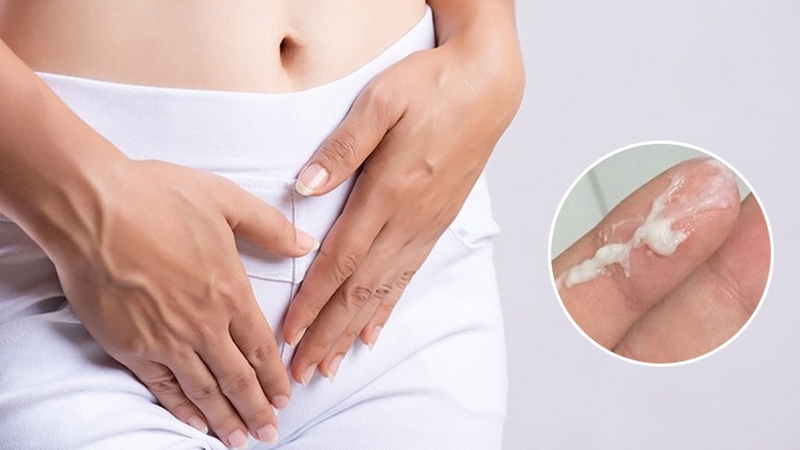 Vùng kín có mảng bám màu trắng là dấu hiệu bệnh gì? 2