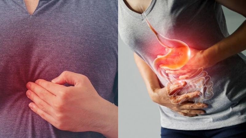 Vùng thượng vị ở đâu? Những nguyên nhân gây đau vùng thượng vị 1