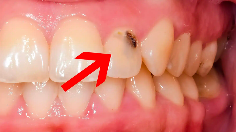 Tiêu trắng: Một loại gia vị có nhiều tác dụng chữa bệnh 5