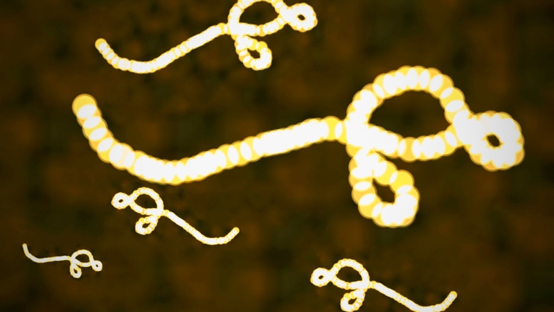 Ebola là bệnh do virus gây ra, có thể diễn tiến nặng