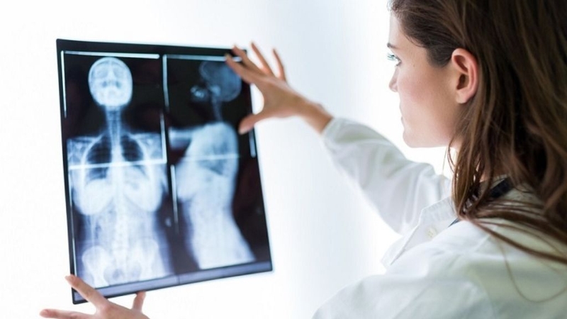 Xạ hình xương: Phương pháp xét nghiệm bệnh hiệu quả 3